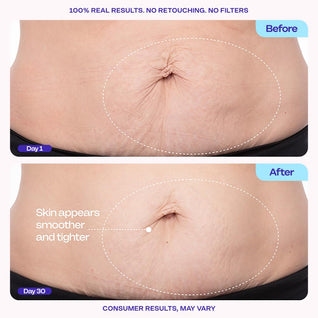 Tighten & Smooth Belly Cream