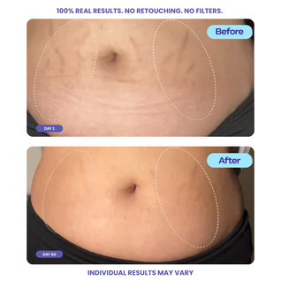 Tighten & Smooth Belly Cream